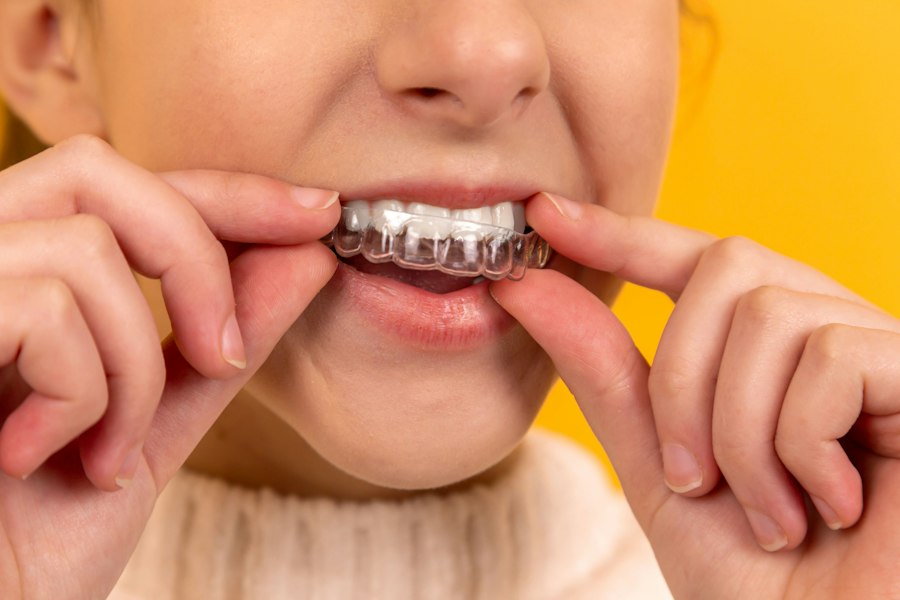 Instrumental dental real esterilizado